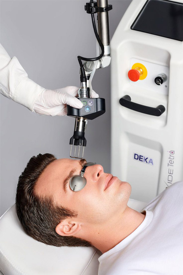 Stock image of a male patient being treated with coolpeel laser treatment.