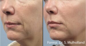 forma-before-after-dr-s-mulholland-preview-1_compressed