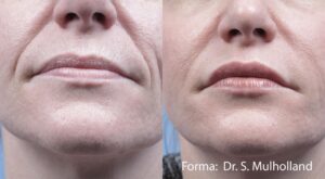 forma-before-after-dr-s-mulholland-preview-2_compressed