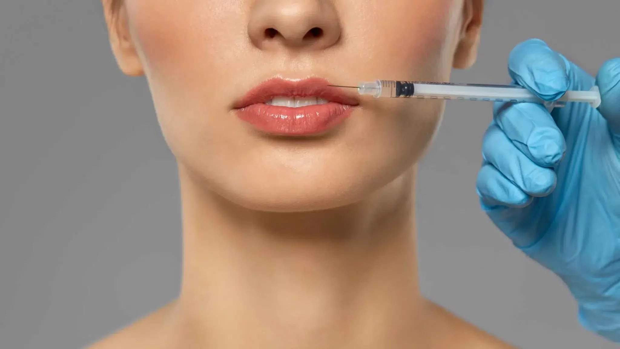 A Comprehensive Guide to Lip Fillers in Los Angeles